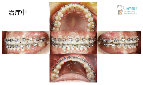 QQ截图20180921091120