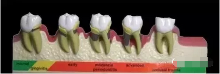 QQ截图20181106164737