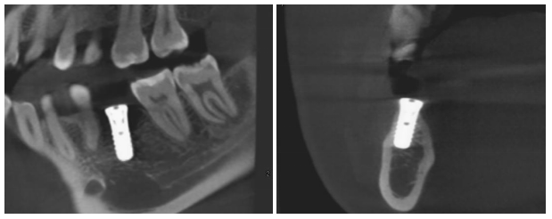 QQ截图20171120090135.png QQ截图20171120090135.png