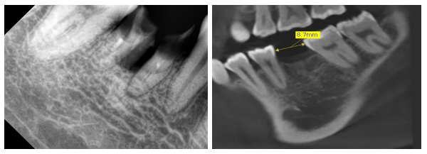 QQ截图20171120085238.png QQ截图20171120085238.png