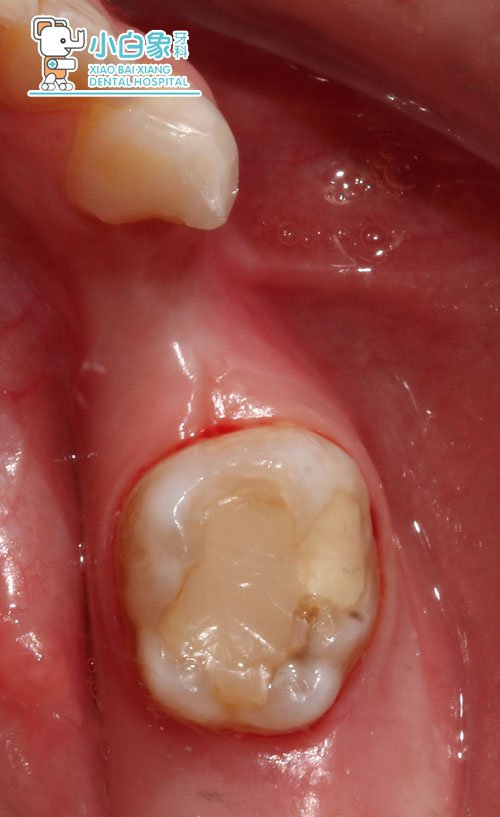 图片1.jpg 图片1.jpg