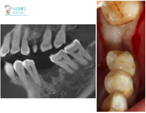 QQ截图20181120085330