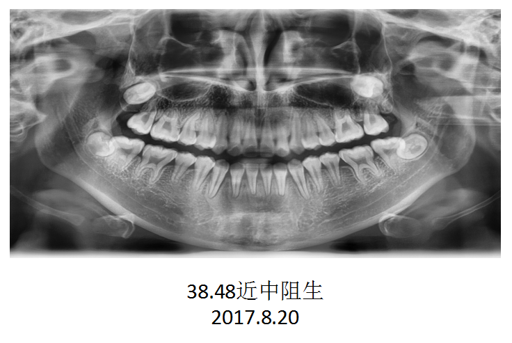 QQ截图20171021153931.png