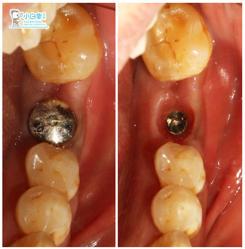 QQ截图20181120085511