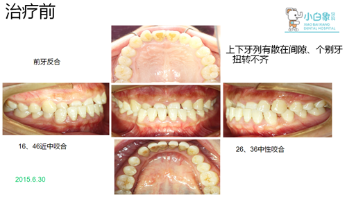 QQ截图20180921091101
