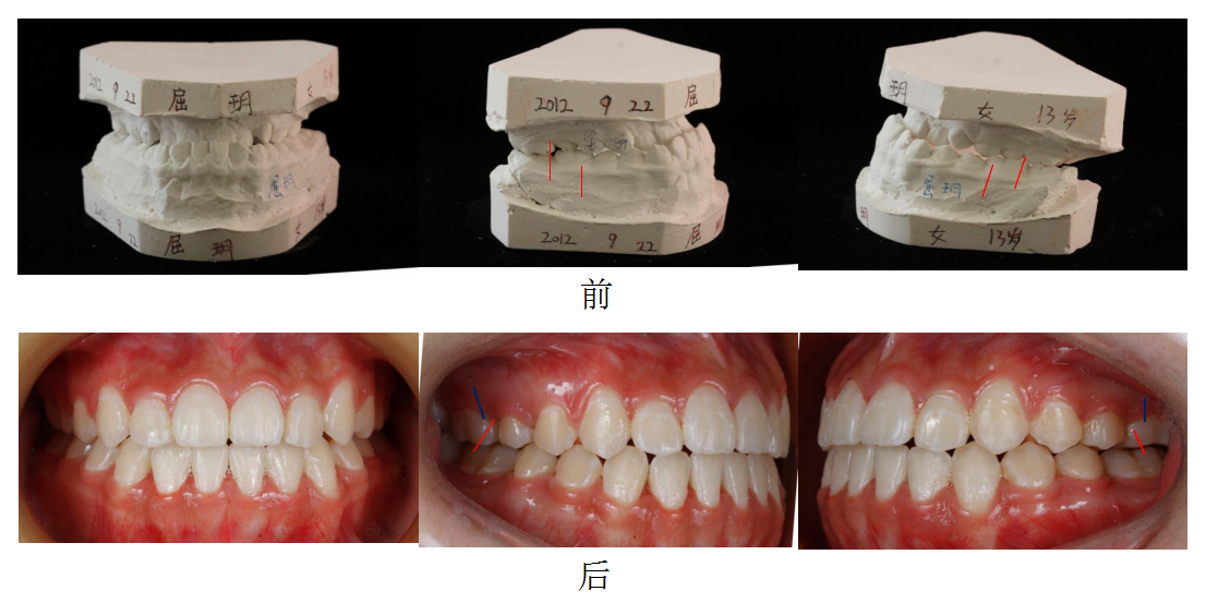 QQ截图20171021154100