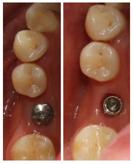 QQ截图20171120090342.png QQ截图20171120090342.png