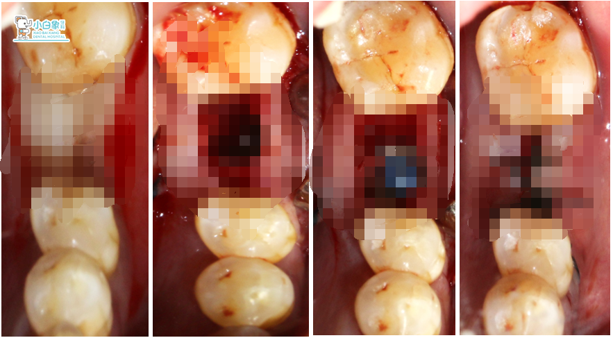 QQ截图20181120085440