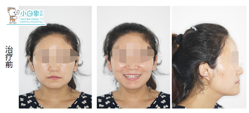 QQ截图20180921091041