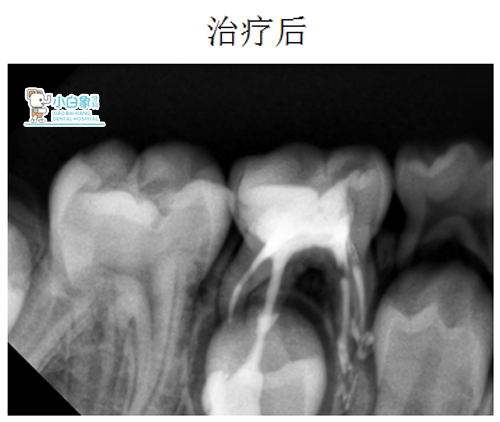 QQ截图20181220151744