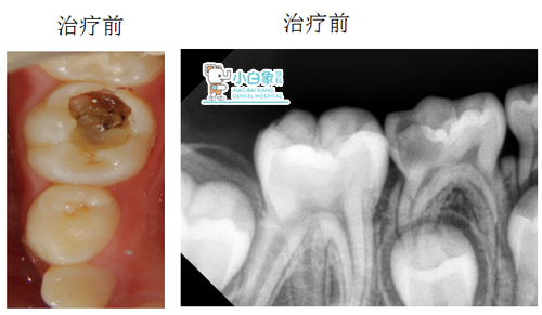 QQ截图20181220151709