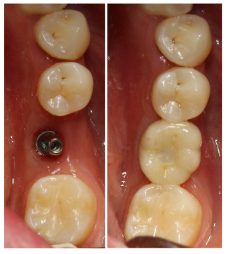 QQ截图20171120090554.png QQ截图20171120090554.png