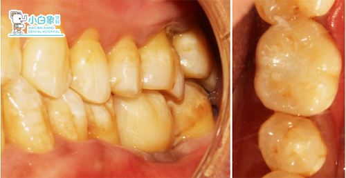 QQ截图20181120085551