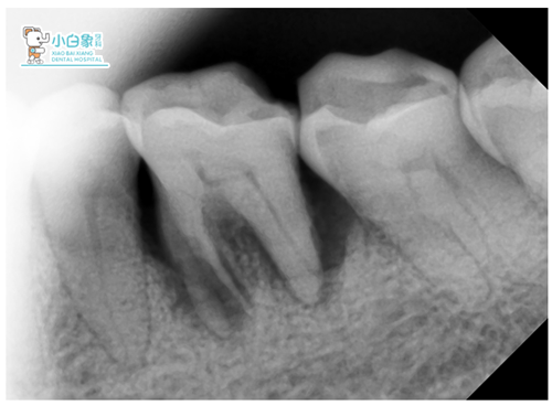 QQ截图20181120085313