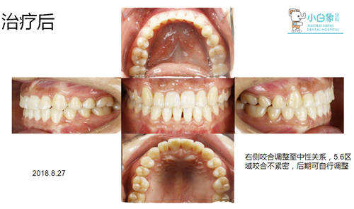 QQ截图20180921091143