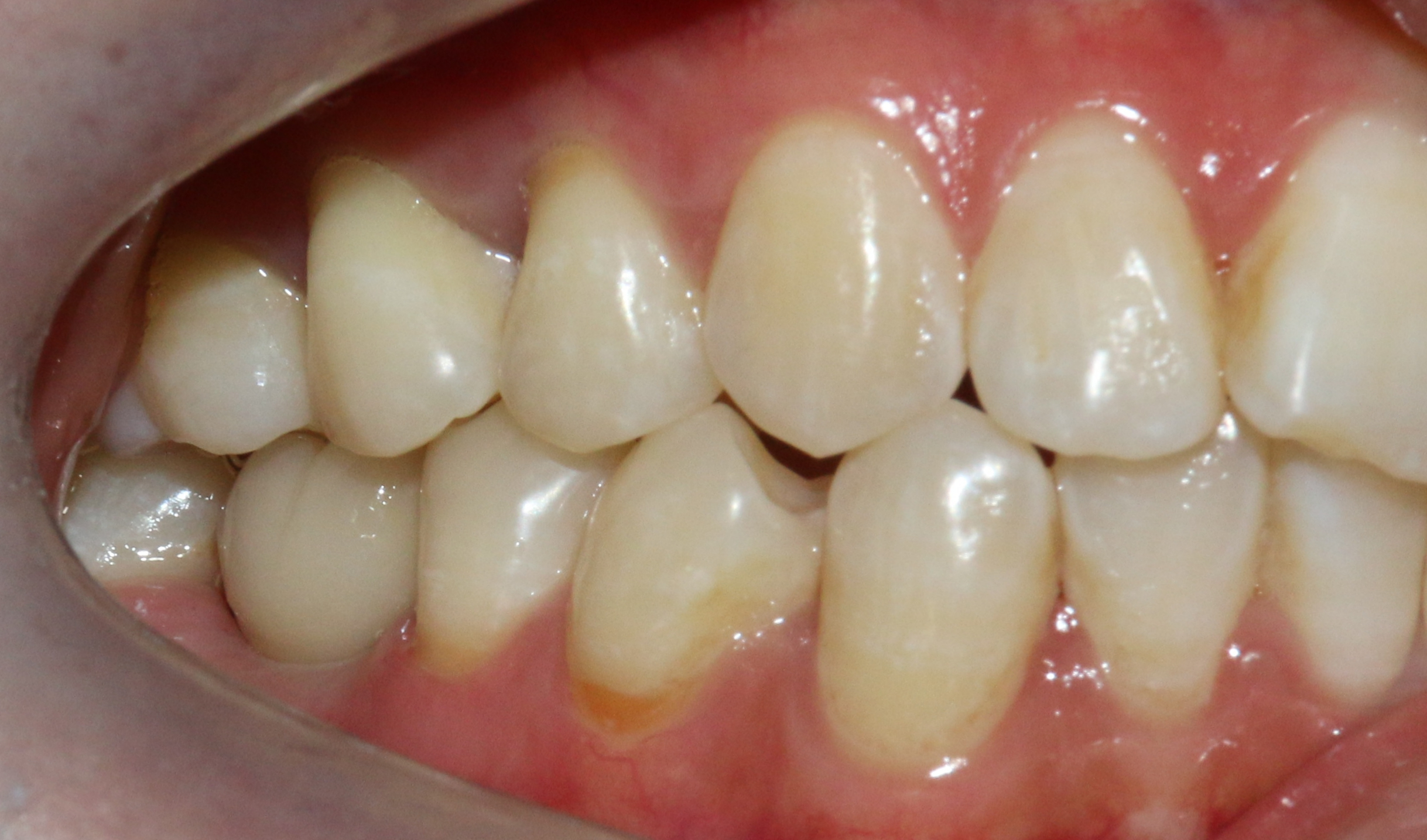 图片2.png 图片2.png