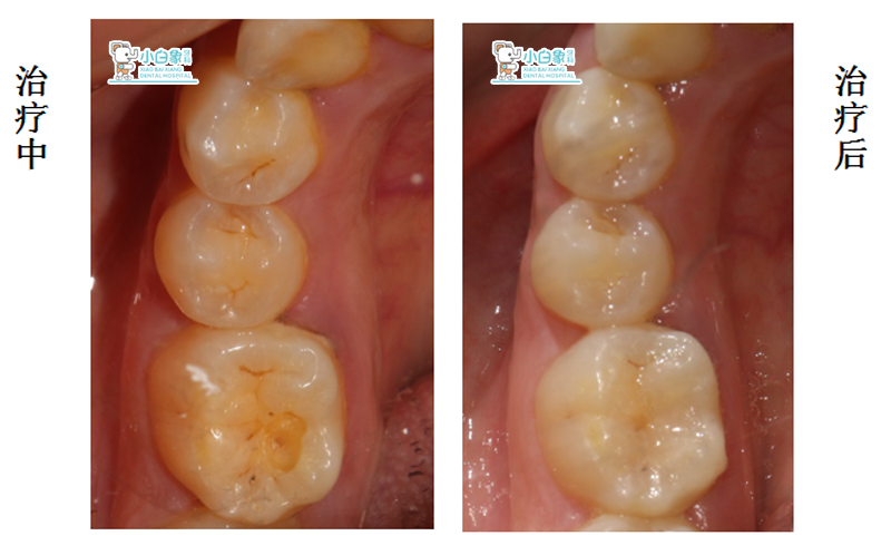 QQ截图20180518161657